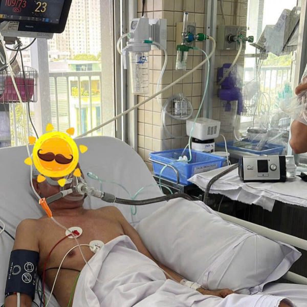 Có cần đơn bác sĩ để mua hoặc thuê máy CPAP tại Việt Nam không và những điều người dùng cần biết trước khi lựa chọn thiết bị