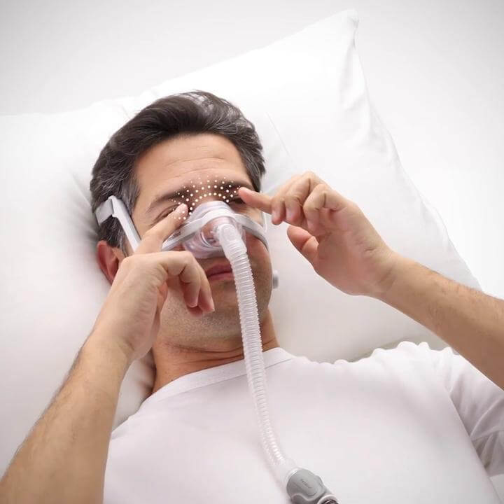 Những khó khăn trong trải nghiệm ban đầu như cảm giác khó chịu, lo lắng hoặc chưa quen với mặt nạ có thể ảnh hưởng đến việc duy trì sử dụng CPAP.